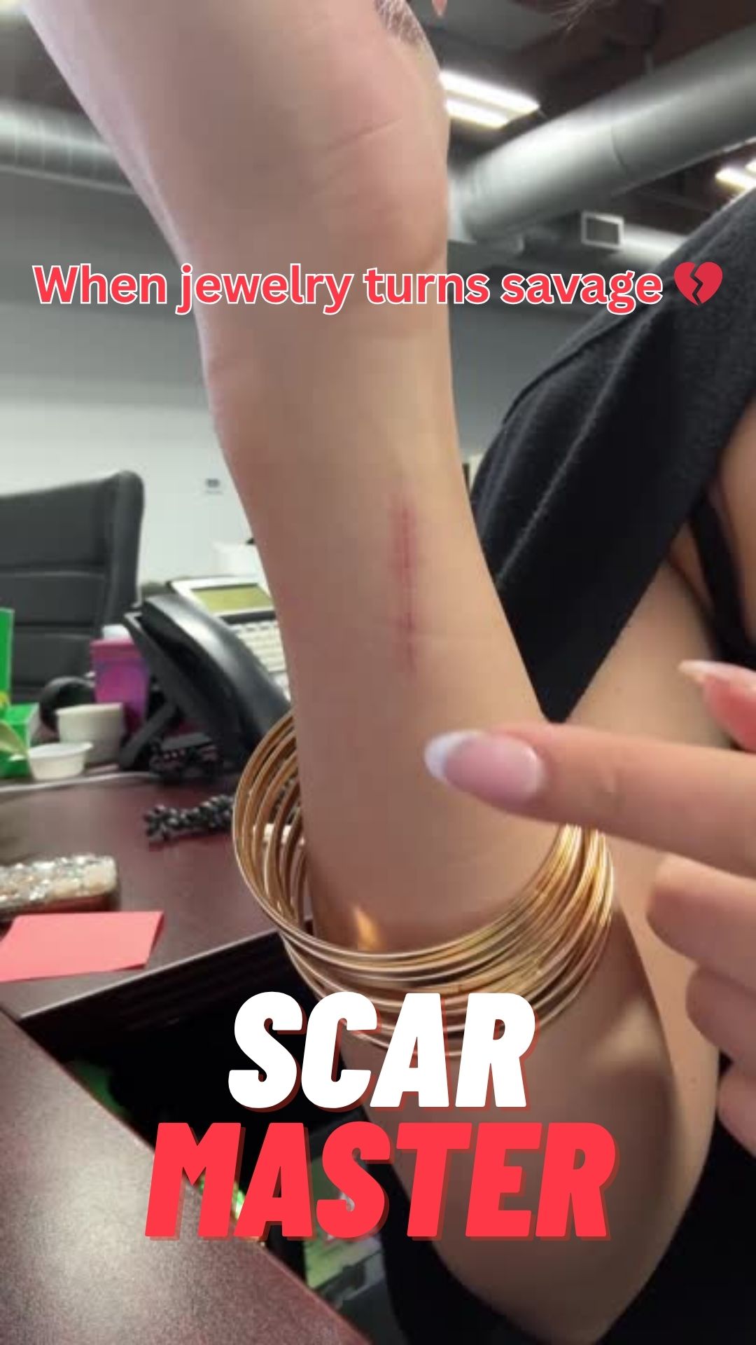 thumbnail video image 2 of Ebanel Silicone Scar Gel with Allantoin, Emu Oil, Vitamin E and Onion Extract, For Old & New Scars from Surgeries, C-Section, Injuries, Burns & More, 2 of 8