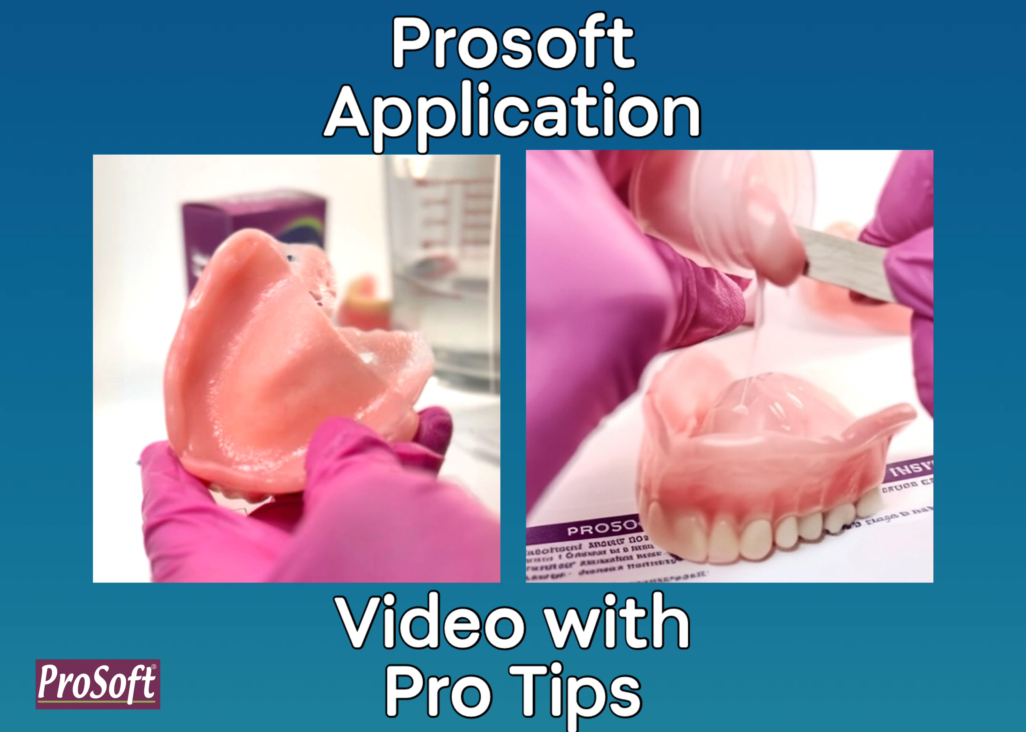 thumbnail video image 2 of ProSoft Denture Reliner 4 Relines for Loose Dentures, Soft Denture Reline Kit that Tightens and Cushions with Comfort, 2 of 9